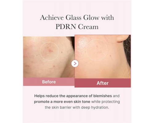 Crema idratante rosa all'acido ialuronico e PDRN MediCube