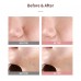 Trattamento spot rosa Good Bye Blemish Mizon