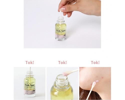 Trattamento spot rosa Good Bye Blemish Mizon