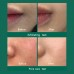 Toner in mist corpo agli acidi AHA, BHA e PHA contro acne 30 Days Miracle Some By Mi